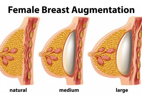 breast enlargement payment plan